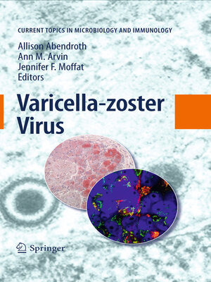 cover image of Varicella-zoster Virus